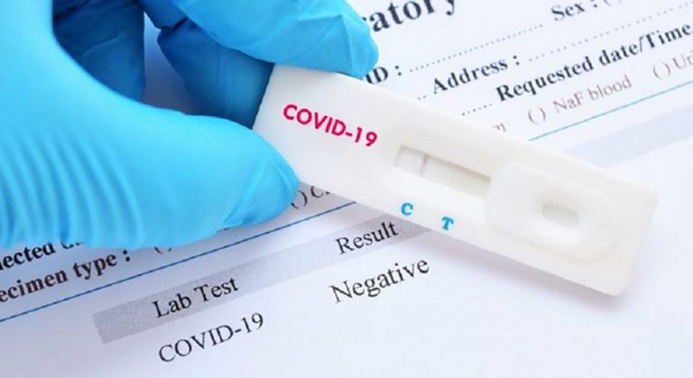 Sanidad trabaja en un proyecto avanzado para hacer test rápidos de diagnóstico del COVID-19