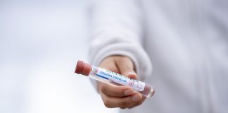 Llaman a la tranquilidad tras el positivo por coronavirus detectado este martes en Lepe