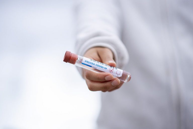 Llaman a la tranquilidad tras el positivo por coronavirus detectado este martes en Lepe